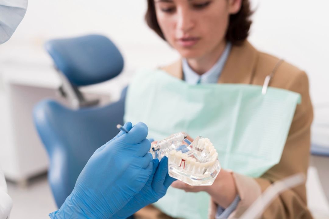 everything you should know before choosing full mouth dental implants